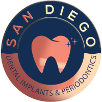 Dental implants san diego